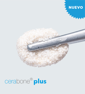 Cerabone® Plus