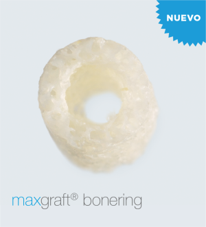 Maxgraft® Bonering